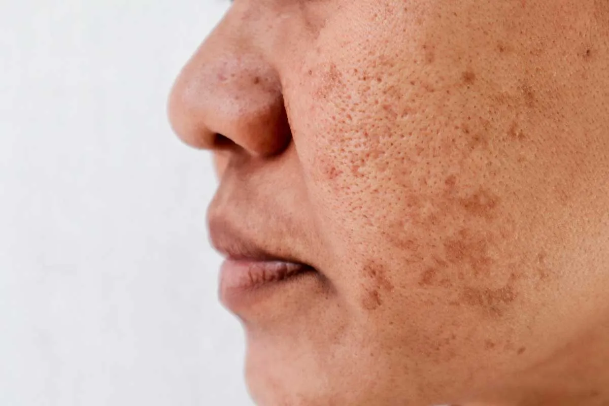 Best Dermatologist in Pakistan